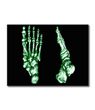 Greetings cards and post cards featuring the bones of the human foot