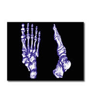 Greetings cards and post cards featuring the bones of the human foot